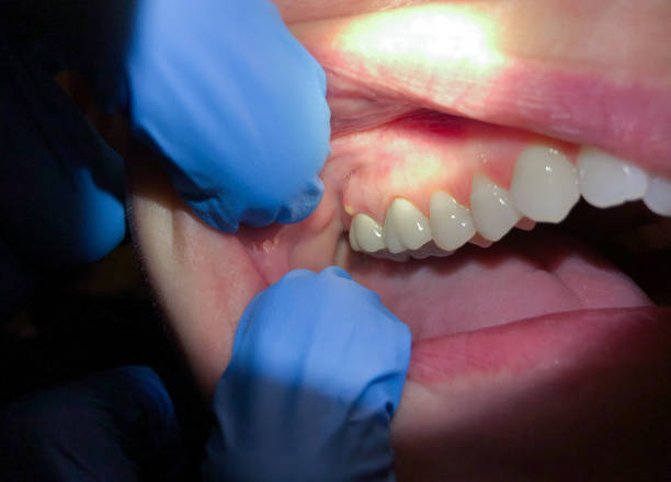 Best Cracked Tooth Emergency Dentist  in Cactus Flats, AZ
