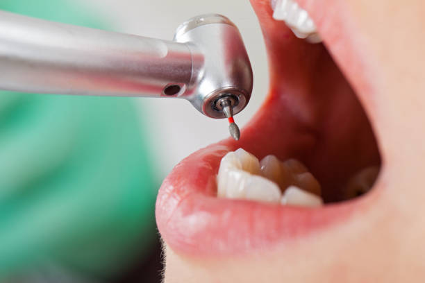 Best Knocked-Out Tooth Emergency  in Cactus Flats, AZ